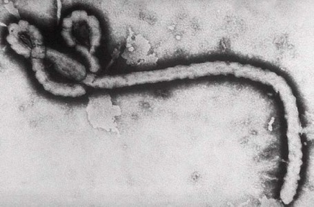 EBOLAVIRUS