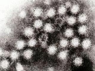 Norovirus-09-29-12_pk6Eo