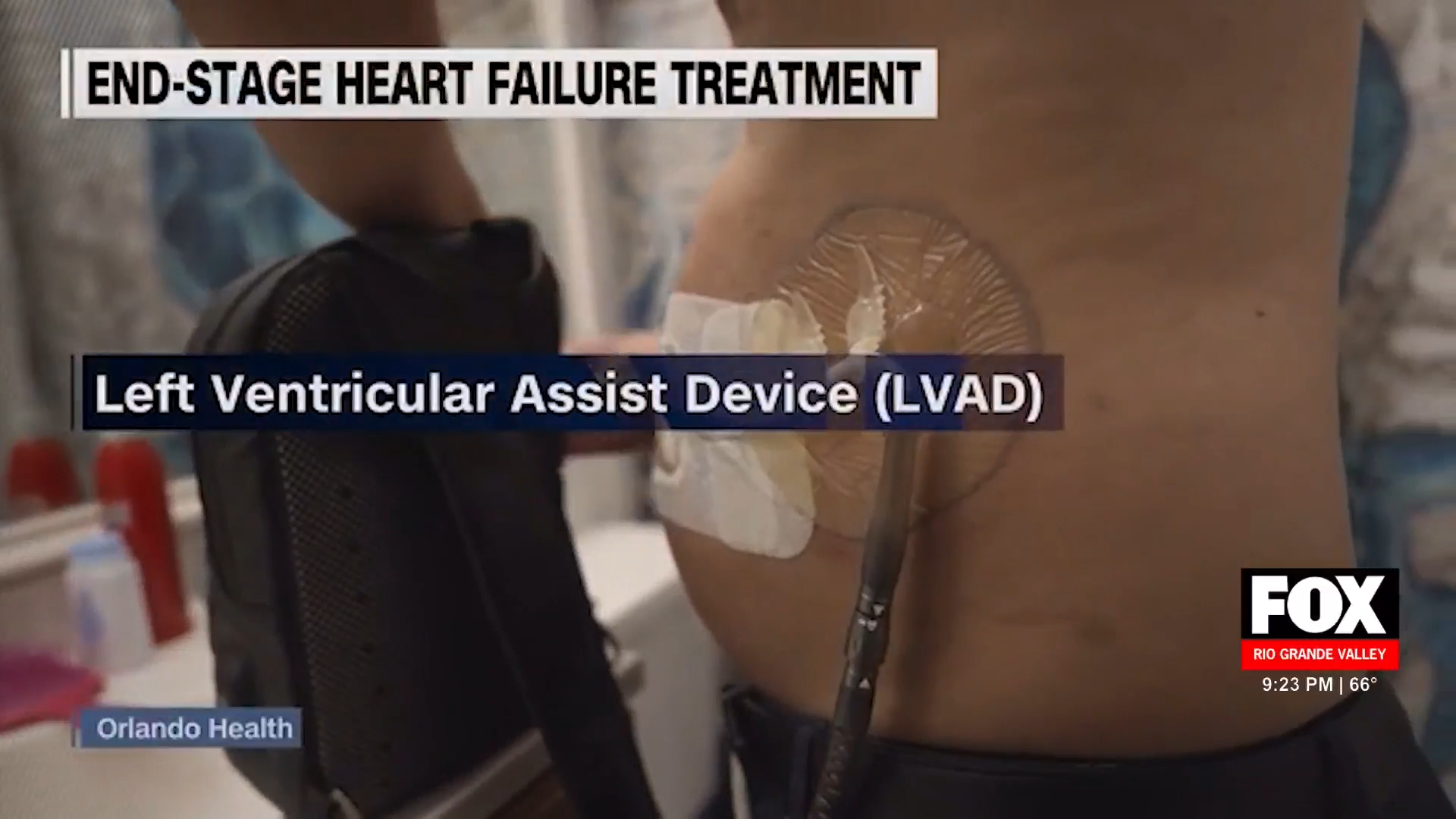 Heart Disease: A Shocking Survival Story with a Life-Saving Twist