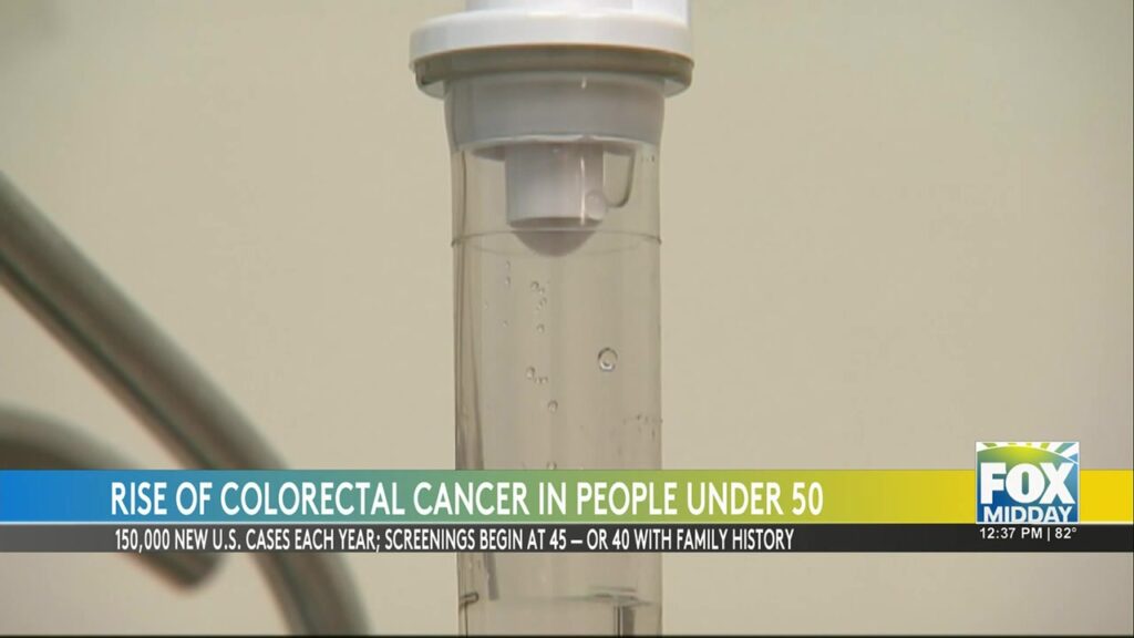 Rising Colon Cancer Rates Among Young Americans colon cancer