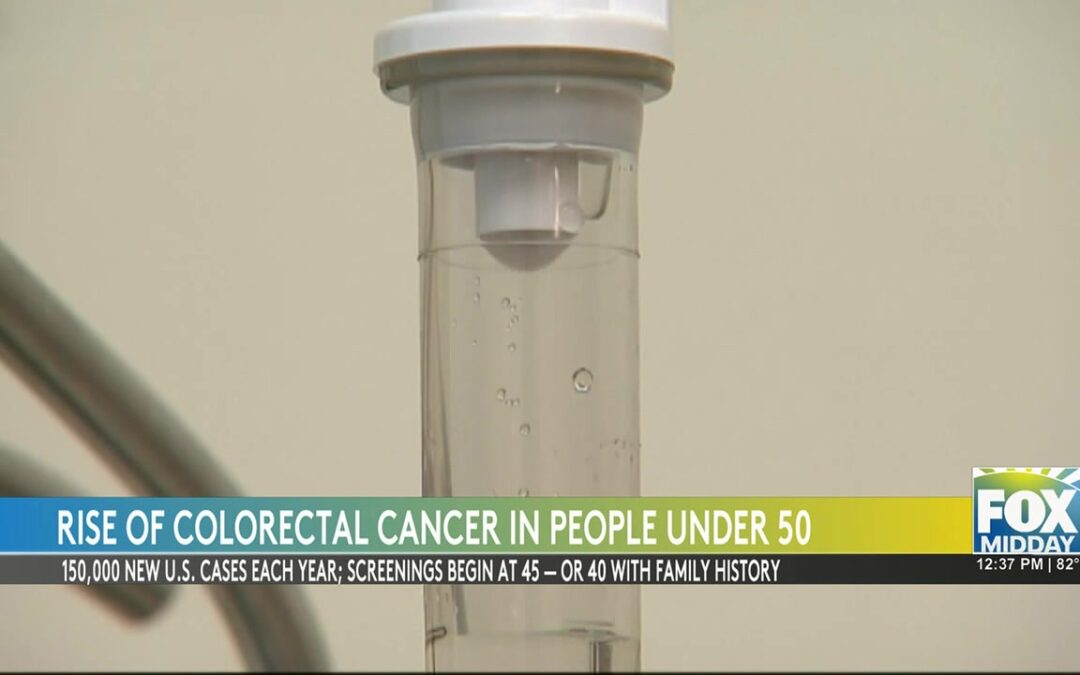 Rising Colon Cancer Rates Among Young Americans