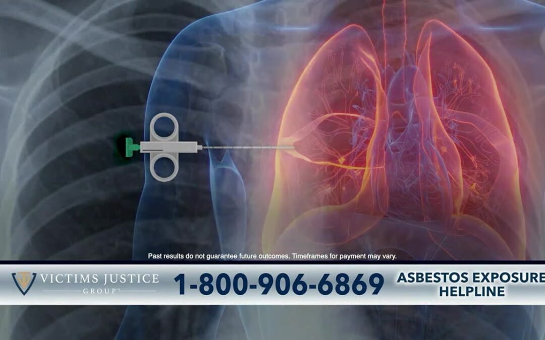 Justice For Asbestos Victims: Significant Compensation Awaited
