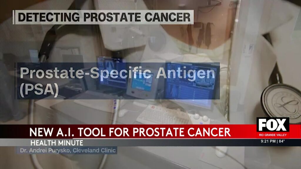 Prostate Cancer Detection Gets AI Boost prostate cancer