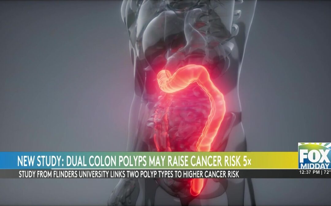 Colonoscopy Study Reveals Increased Cancer Risks