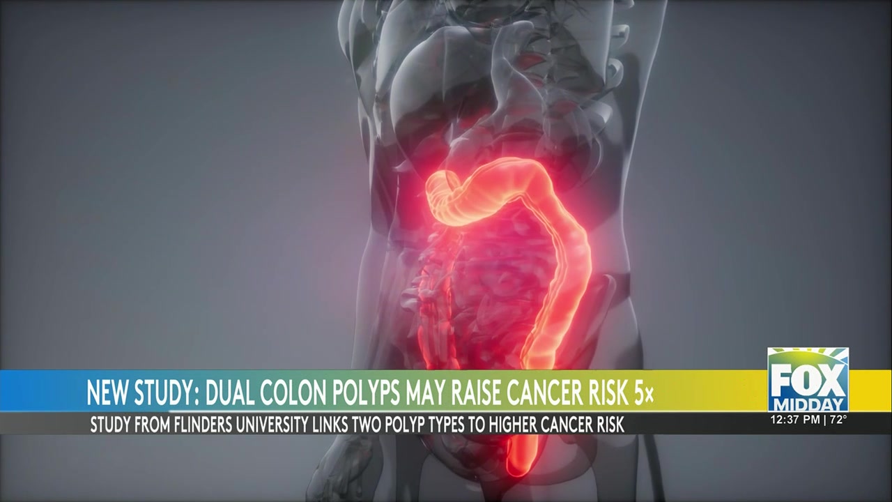 Colonoscopy Study Reveals Increased Cancer Risks