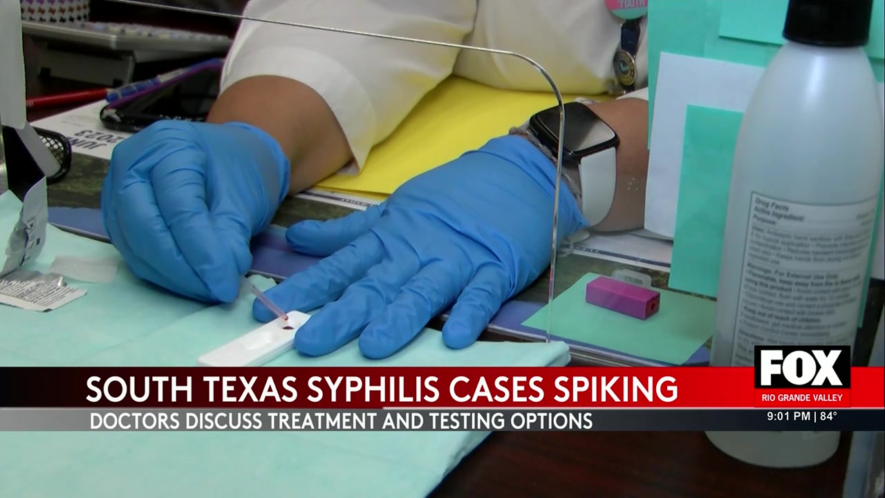 Syphilis Cases Surge In South Texas: Health Experts Sound Alarm