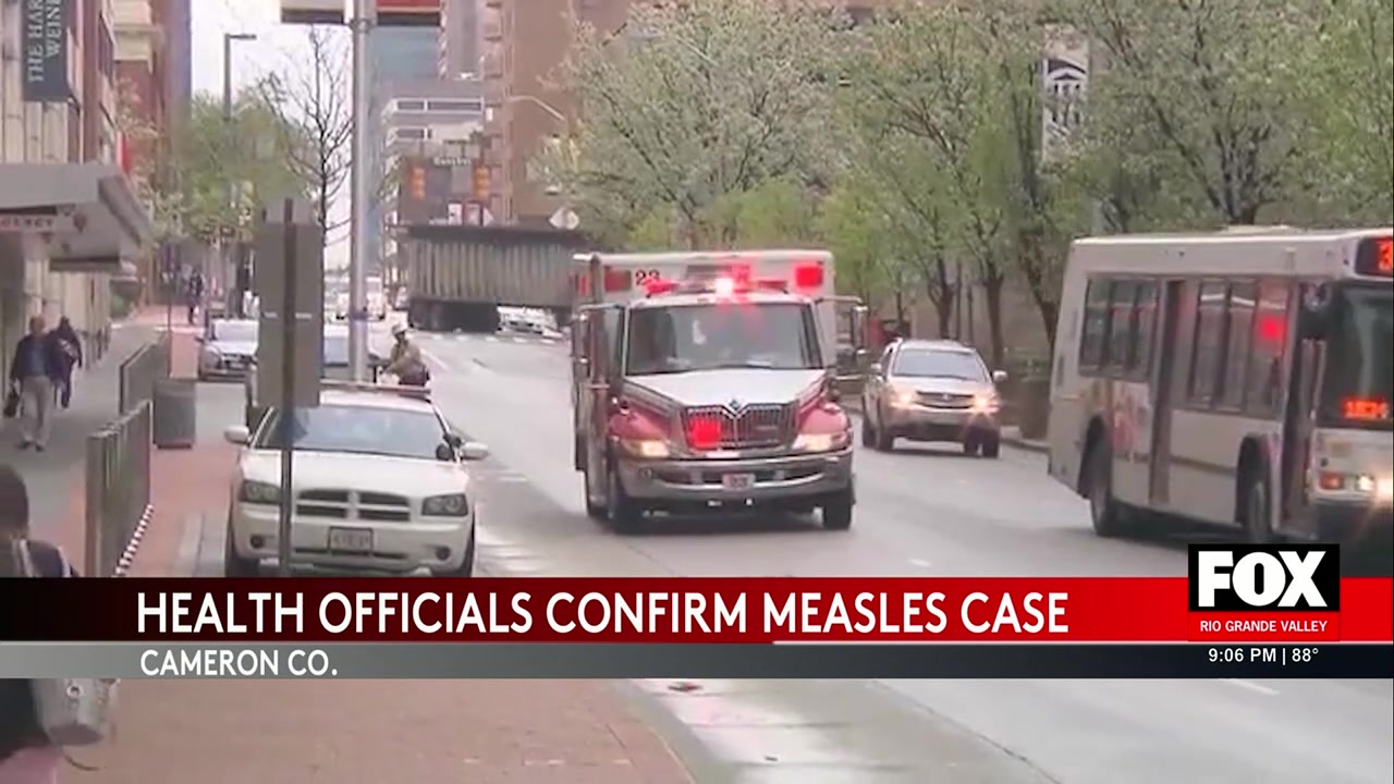 Measles Case Cameron County: Cameron County Confirms Measles Case Amid National Spike