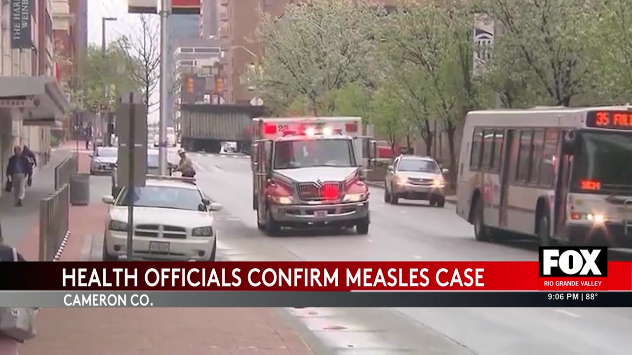 Cameron County Reports Measles Case: Health Officials Urge Vaccination, Awareness