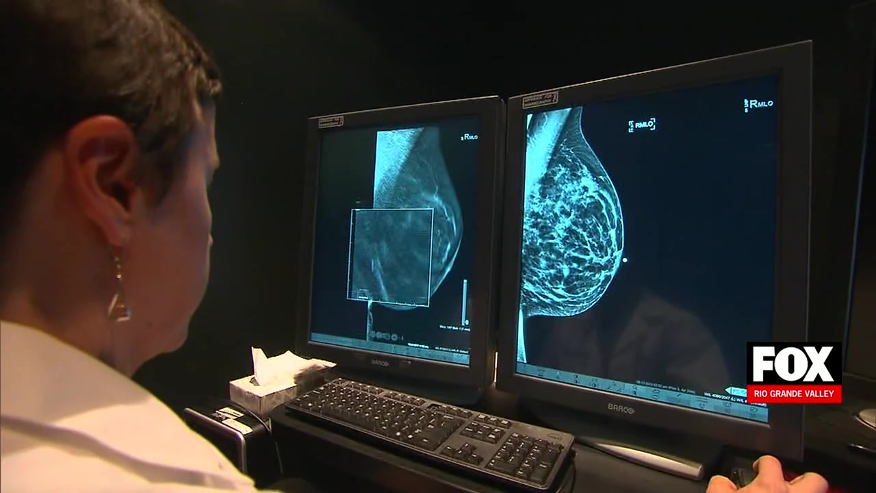 Alcohol Breast Cancer: Young Adults Unaware Of Alcohol-Related Cancer Risks, Studies Warn On Holiday Weekend