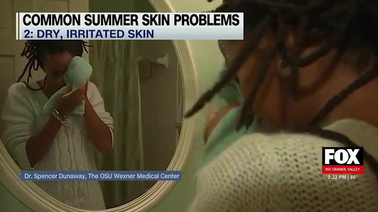 Summer Skin Problems: Summer Health: Dermatologist Shares Tips To Prevent Skin Problems