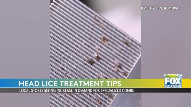 Head Lice: Summer Lice Outbreaks Surge In South Texas: How To Protect Your Family